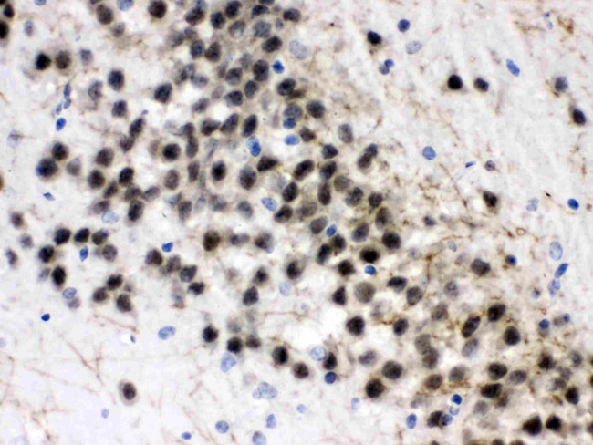 ZWINT Antibody in Immunohistochemistry (Paraffin) (IHC (P))