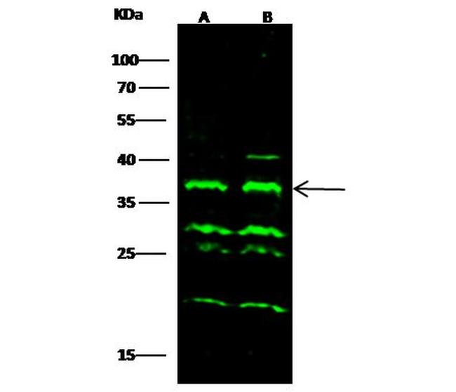 CTLA-4 Antibody in Western Blot (WB)