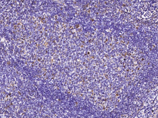 ENPP2 Antibody in Immunohistochemistry (Paraffin) (IHC (P))