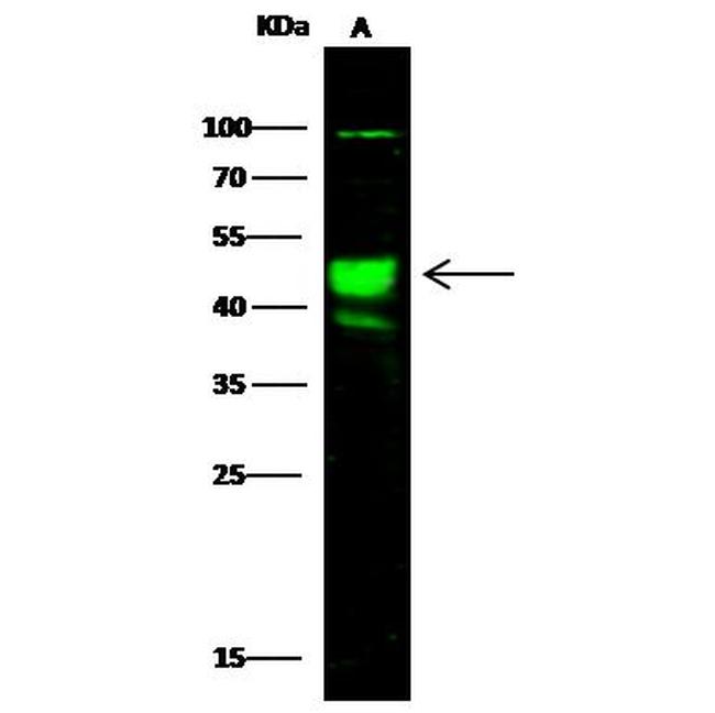 AARSD1 Antibody in Western Blot (WB)