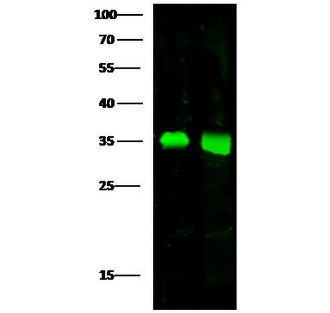 ACBD6 Antibody in Western Blot (WB)