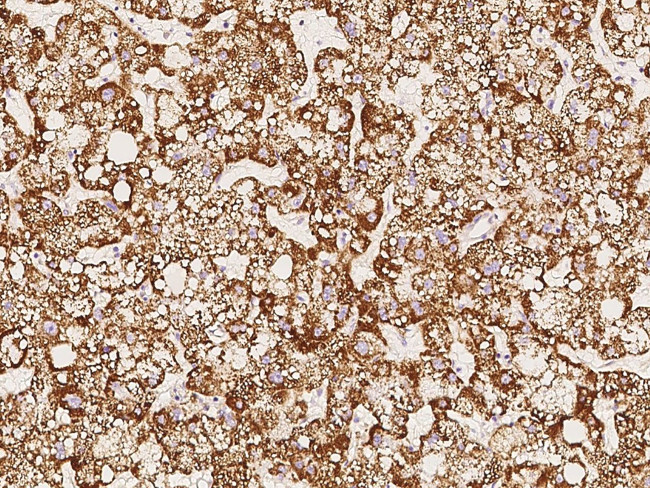 THEM2 Antibody in Immunohistochemistry (Paraffin) (IHC (P))