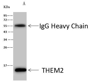 THEM2 Antibody in Immunoprecipitation (IP)