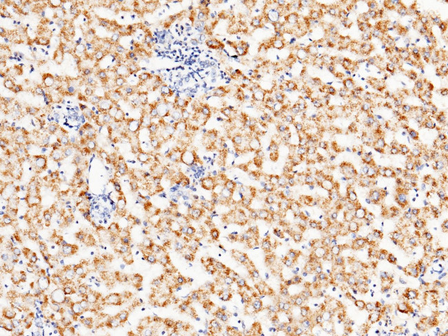 ACOX1 Antibody in Immunohistochemistry (Paraffin) (IHC (P))