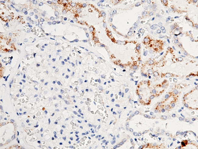 ACOX1 Antibody in Immunohistochemistry (Paraffin) (IHC (P))