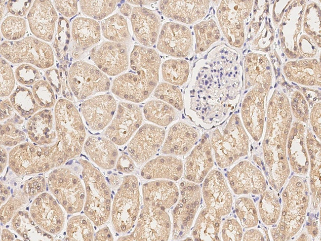 Acid Phosphatase 1 Antibody in Immunohistochemistry (Paraffin) (IHC (P))