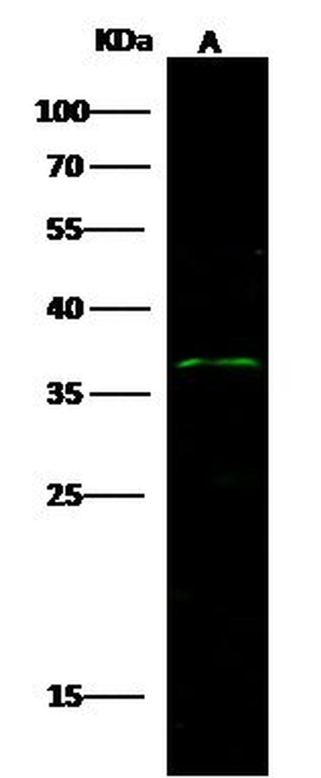 Tartrate Resistant Acid Phosphatase Antibody in Western Blot (WB)