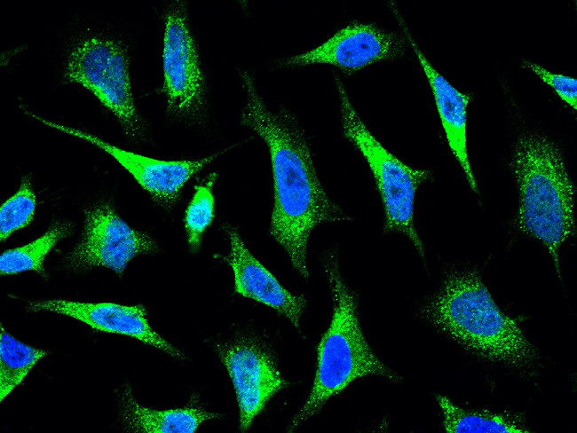 Arp3 Antibody in Immunocytochemistry (ICC/IF)