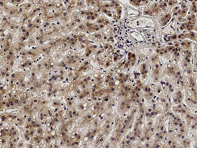 ACVRL1 Antibody in Immunohistochemistry (Paraffin) (IHC (P))