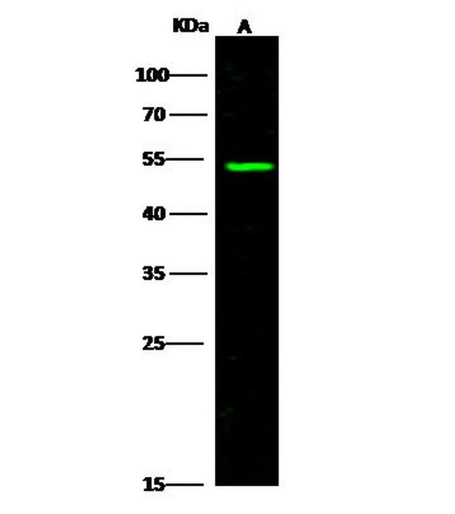 ACVRL1 Antibody in Western Blot (WB)