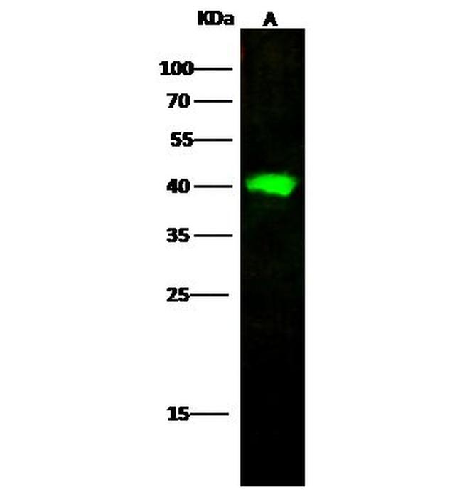 Adenosine Deaminase Antibody in Western Blot (WB)