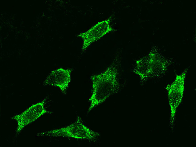 beta-2 Adrenergic Receptor Antibody in Immunocytochemistry (ICC/IF)