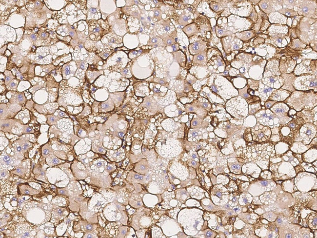 beta-2 Adrenergic Receptor Antibody in Immunohistochemistry (Paraffin) (IHC (P))