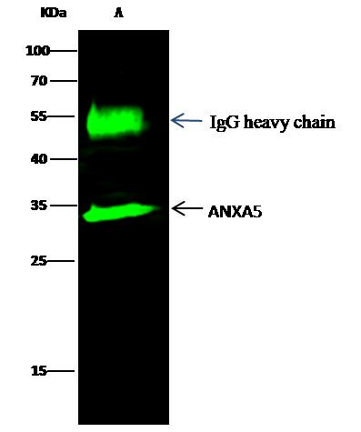 Annexin V Antibody in Immunoprecipitation (IP)