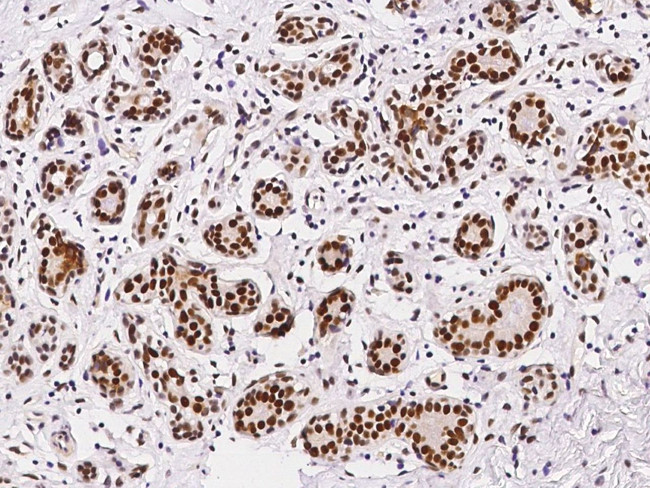 APE1 Antibody in Immunohistochemistry (Paraffin) (IHC (P))