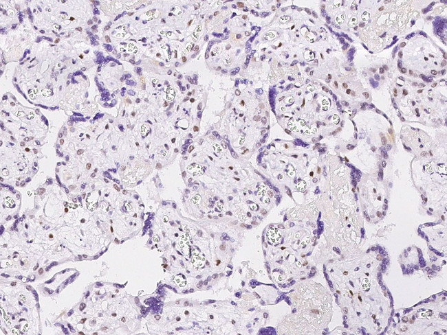 APE1 Antibody in Immunohistochemistry (Paraffin) (IHC (P))