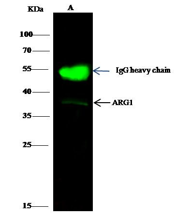 Arginase 1 Antibody in Immunoprecipitation (IP)