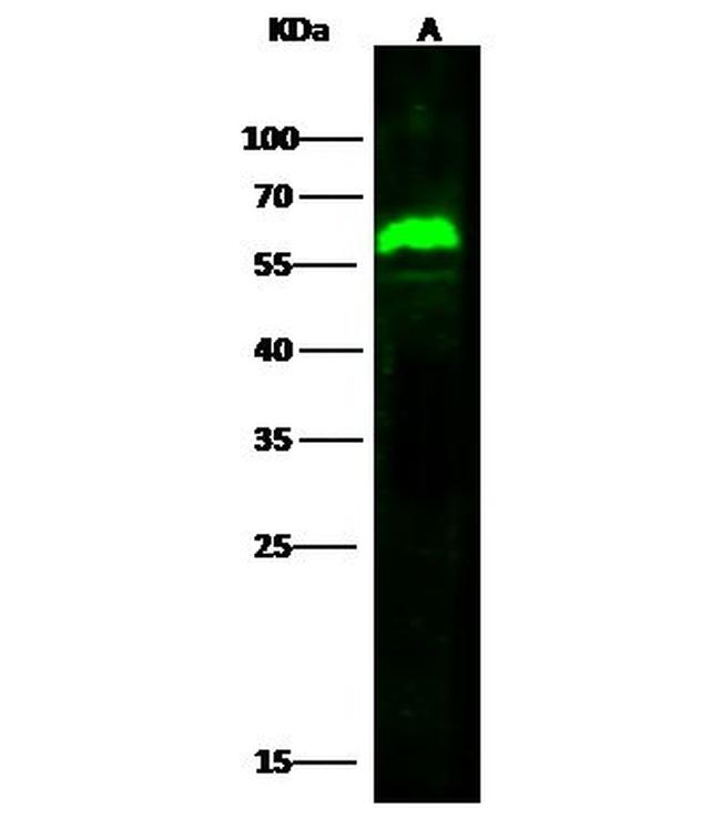 Arylsulfatase A Antibody in Western Blot (WB)