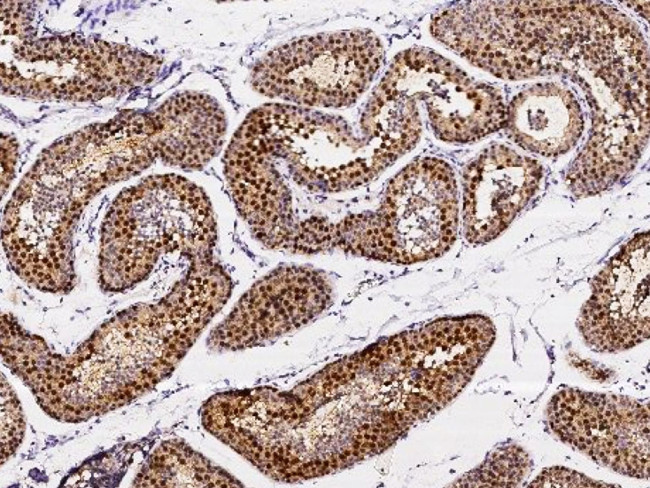 ASF1B Antibody in Immunohistochemistry (Paraffin) (IHC (P))