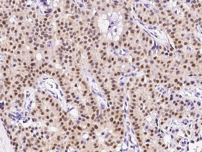 ATF1 Antibody in Immunohistochemistry (Paraffin) (IHC (P))