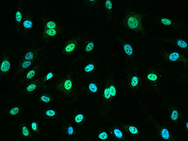 ATF1 Antibody in Immunocytochemistry (ICC/IF)