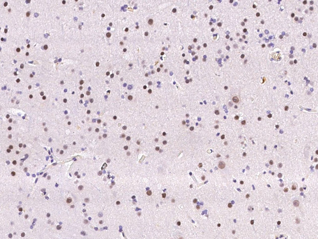 ATF Antibody in Immunohistochemistry (Paraffin) (IHC (P))