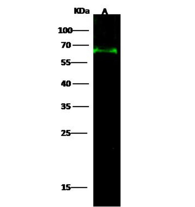 ATF Antibody in Western Blot (WB)