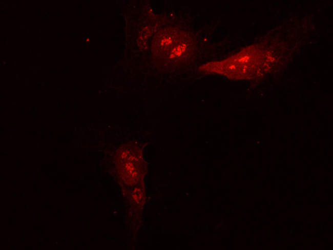 ATG12 Antibody in Immunocytochemistry (ICC/IF)