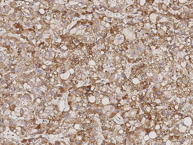 ATP5D Antibody in Immunohistochemistry (Paraffin) (IHC (P))