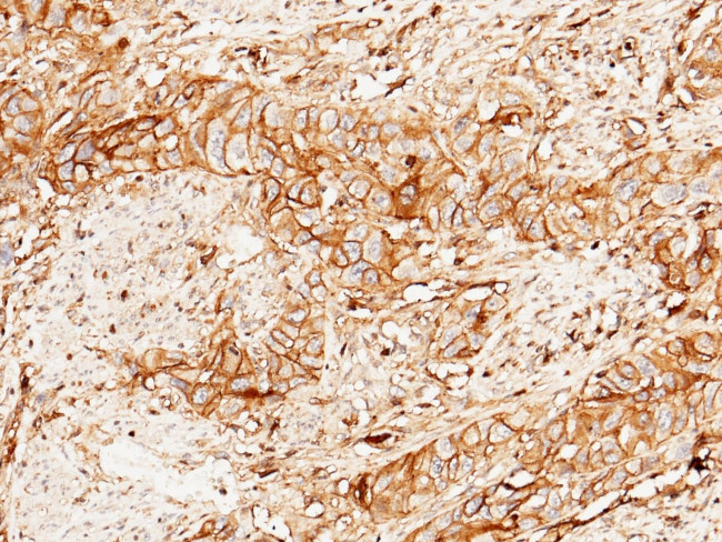 beta-2 Microglobulin/FCRN Antibody in Immunohistochemistry (Paraffin) (IHC (P))