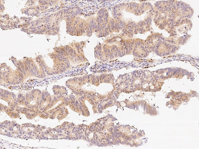 B3GNT2 Antibody in Immunohistochemistry (Paraffin) (IHC (P))