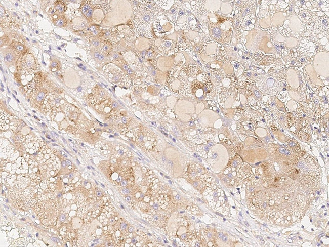 BAD Antibody in Immunohistochemistry (Paraffin) (IHC (P))