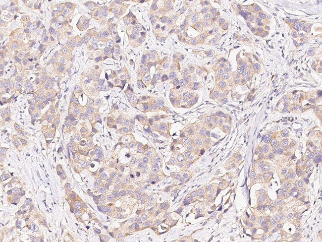 BAD Antibody in Immunohistochemistry (Paraffin) (IHC (P))