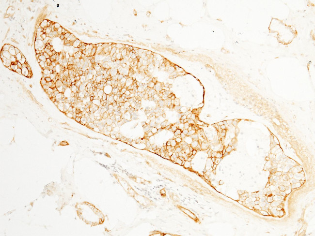 BCAM Antibody in Immunohistochemistry (Paraffin) (IHC (P))