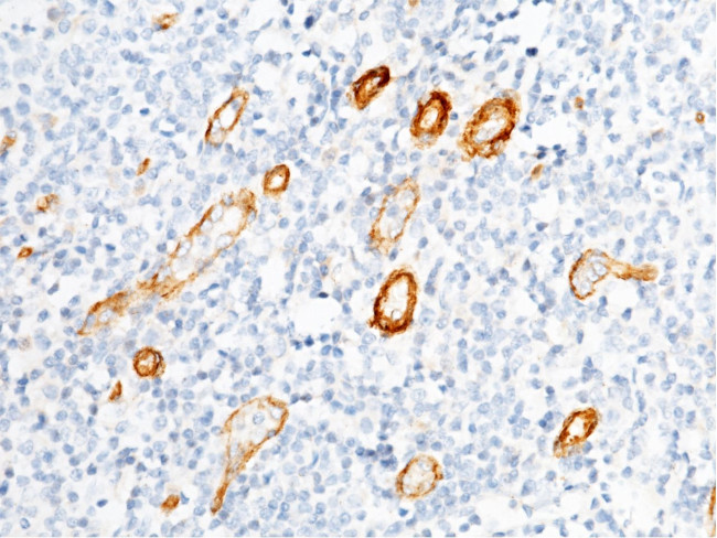 BCAM Antibody in Immunohistochemistry (Paraffin) (IHC (P))