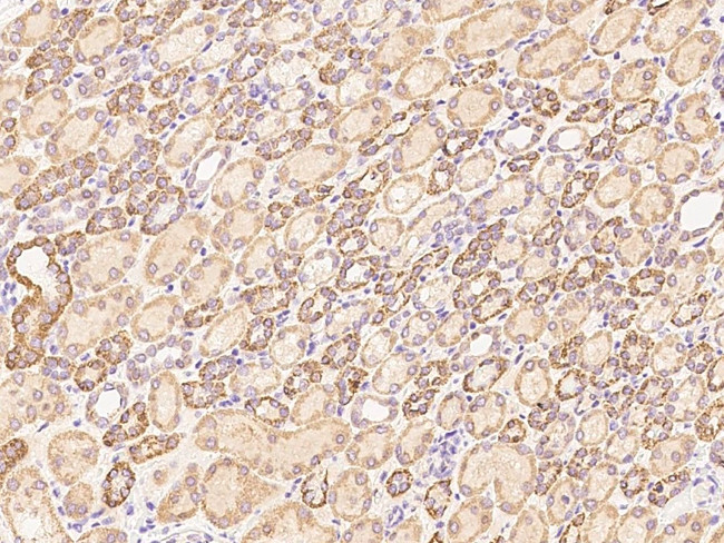 Beclin 1 Antibody in Immunohistochemistry (Paraffin) (IHC (P))