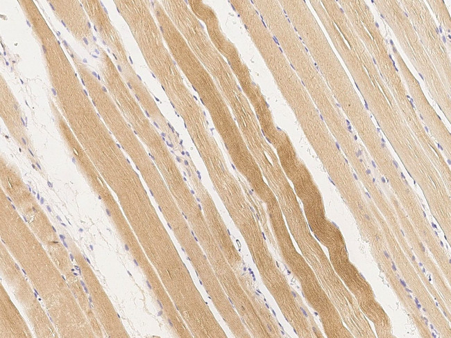 BVES Antibody in Immunohistochemistry (Paraffin) (IHC (P))