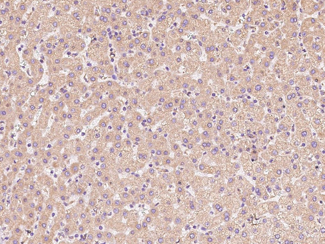 Calreticulin Antibody in Immunohistochemistry (Paraffin) (IHC (P))