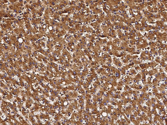 Calreticulin Antibody in Immunohistochemistry (Paraffin) (IHC (P))