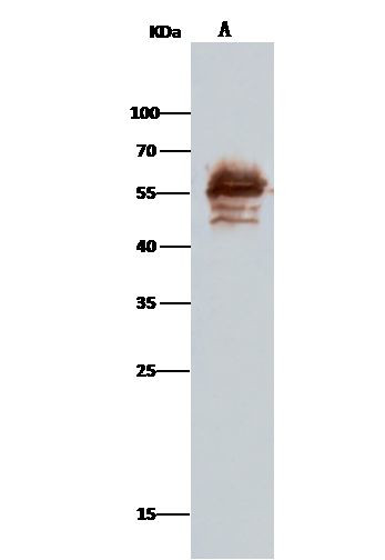 Calreticulin Antibody in Immunoprecipitation (IP)