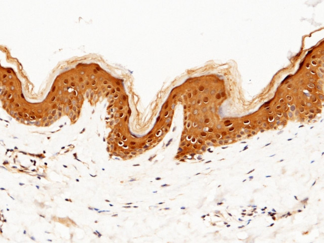 Caspase 14 Antibody in Immunohistochemistry (Paraffin) (IHC (P))