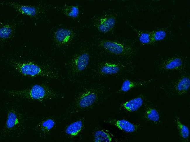 MCP-1 Antibody in Immunocytochemistry (ICC/IF)