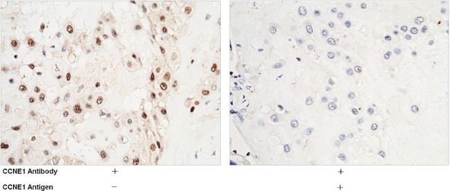 Cyclin E Antibody in Immunohistochemistry (Paraffin) (IHC (P))