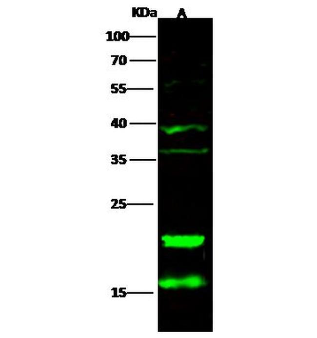 CD3z Antibody in Western Blot (WB)