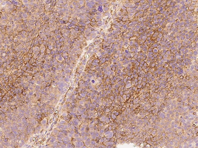 B7-H3 Antibody in Immunohistochemistry (Paraffin) (IHC (P))