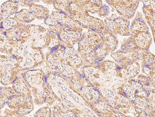 B7-H3 Antibody in Immunohistochemistry (Paraffin) (IHC (P))