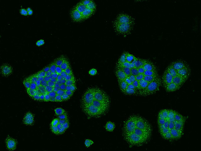 CD47 Antibody in Immunocytochemistry (ICC/IF)