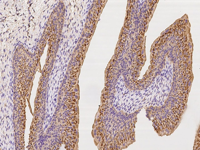 CD47 Antibody in Immunohistochemistry (Paraffin) (IHC (P))