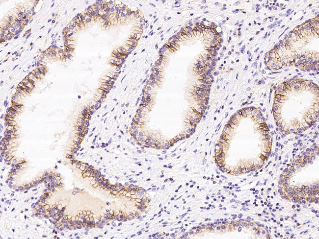 CD47 Antibody in Immunohistochemistry (Paraffin) (IHC (P))