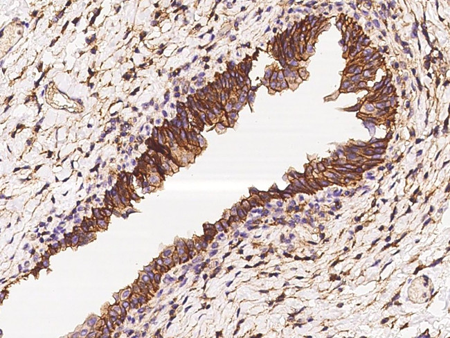 CD47 Antibody in Immunohistochemistry (Paraffin) (IHC (P))